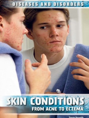cover image of Skin Conditions